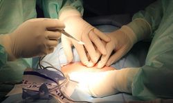 Avusturya'da Geçtiğimiz Yıl 637 Organ Nakli Yapıldı