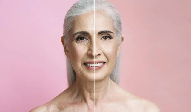 Kolajen takviyesi cildin elastikiyetini artırıyor, peki kırışıklıklar?