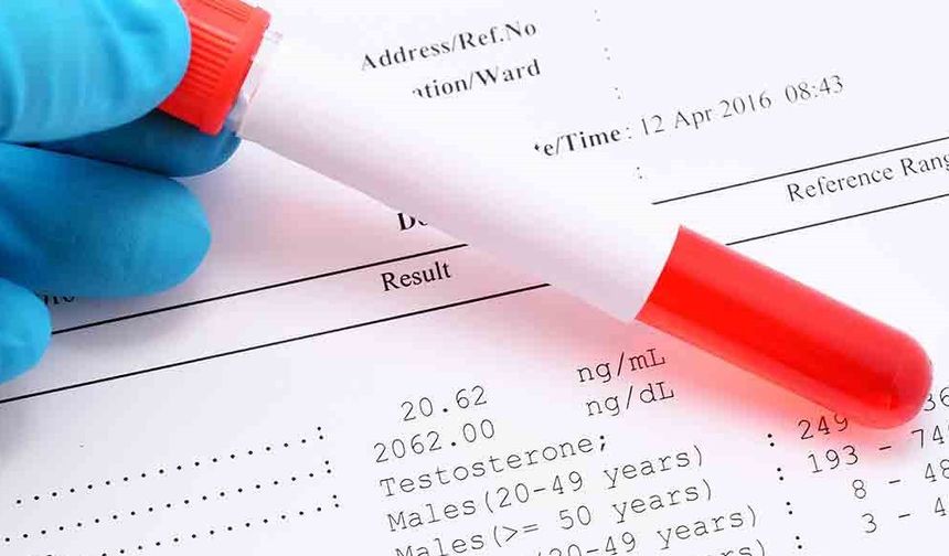 Avusturya’da D Vitamini Kan Testleri Artık Ücretsiz Değil: Hastalar Ücreti Kendileri Ödeyecek